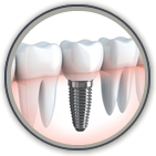 Link to more info about Implant Dentistry