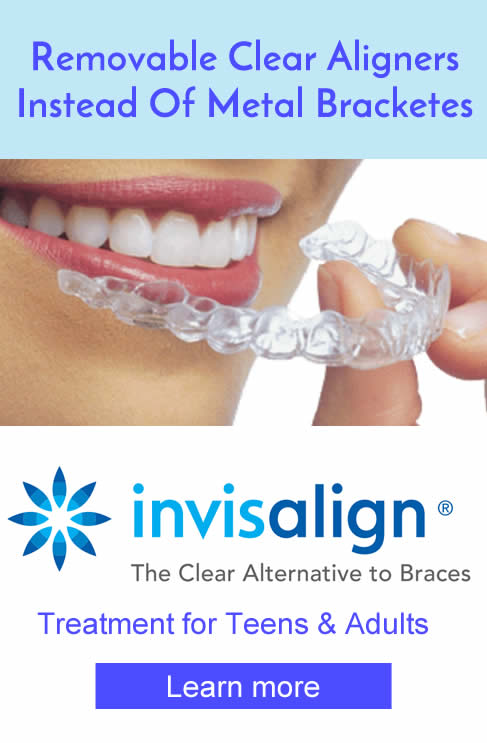 invisalignweston