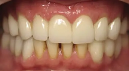 close after cosmetic dentistry smile Dale