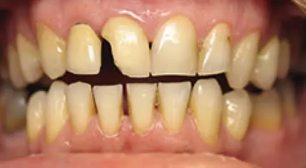 close up before cosmetic dentistry smile Dale